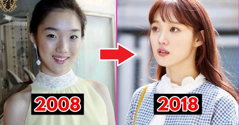 Lee Sung Kyung Plastic Surgery Before and After Photos