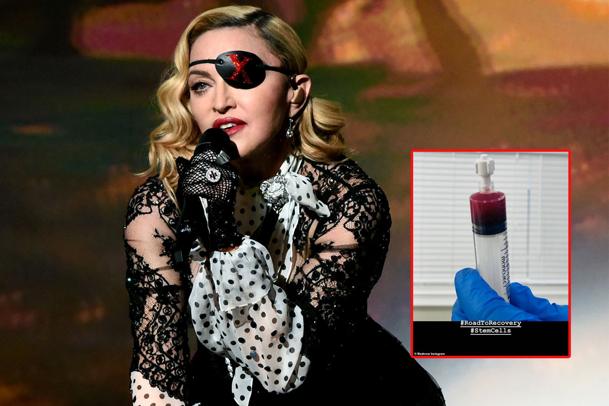 Madonna shares stem cell therapy treatment and X-rays on Instagram