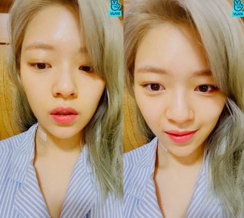 twice-jeongyeon-reveals-that-she-been-dealing-with-neck-injury-1