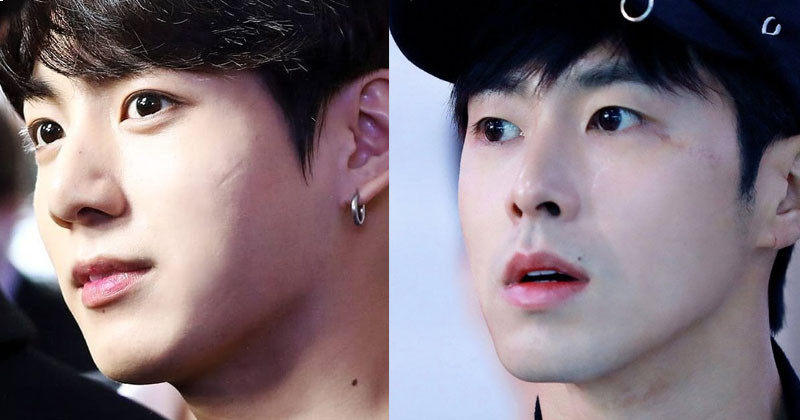 K-Pop Idols Have Scars on Their Faces But Still Look Stunning