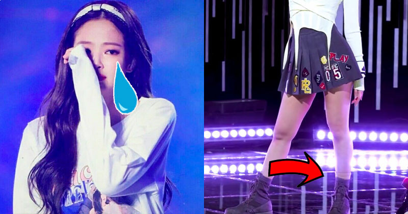 BLINKs Are Worried Over BLACKPINK Jennie For Her Injured Ankle