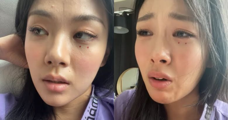 Fans Are Concerned For BIBI’s Mental And Physical Health After She Breaks Down On Instagram Live