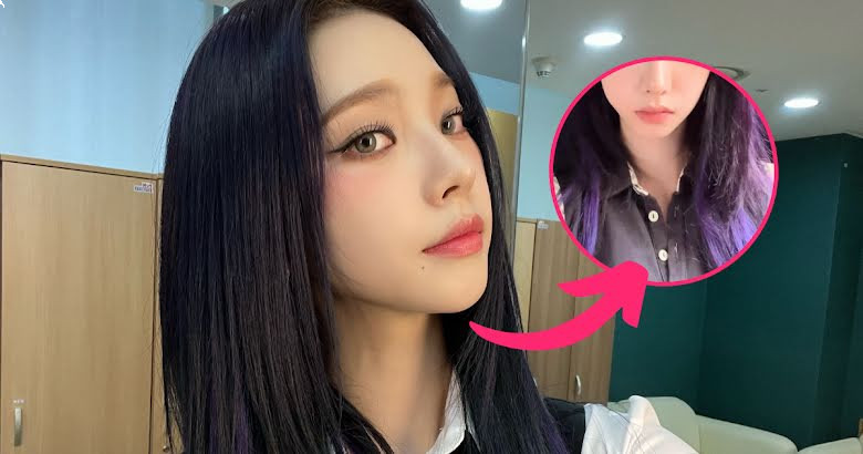 aespa’s Karina Proves Her Visuals Are Always Flawless, Even After Having Her Wisdom Tooth Removed