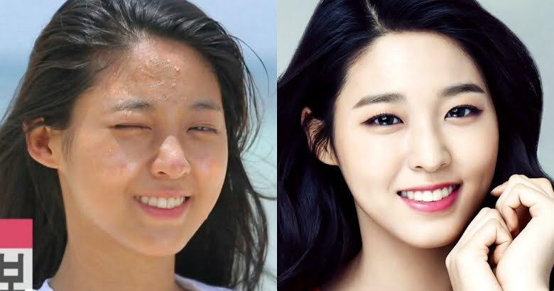 20 Idols Whose Skin Was Seriously Damaged By Makeup
