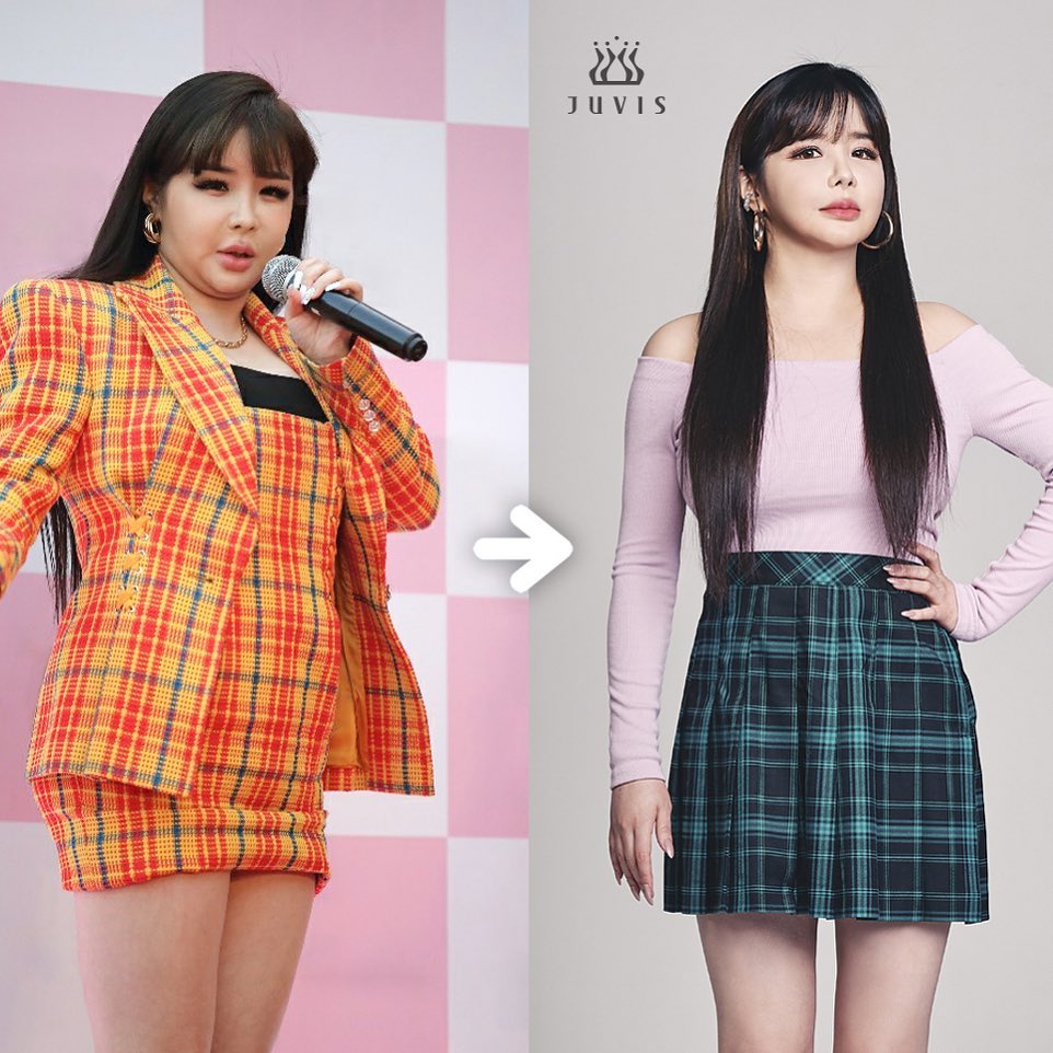 park-bom-shares-she-lost-11kg-and-will-make-comeback-soon
